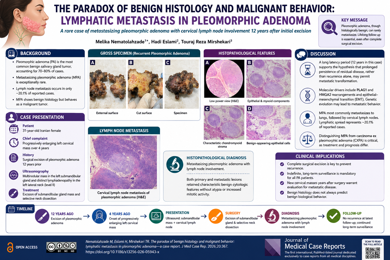 The paradox of benign histology and malignant behavior: lymphatic metastasis in pleomorphic adenoma