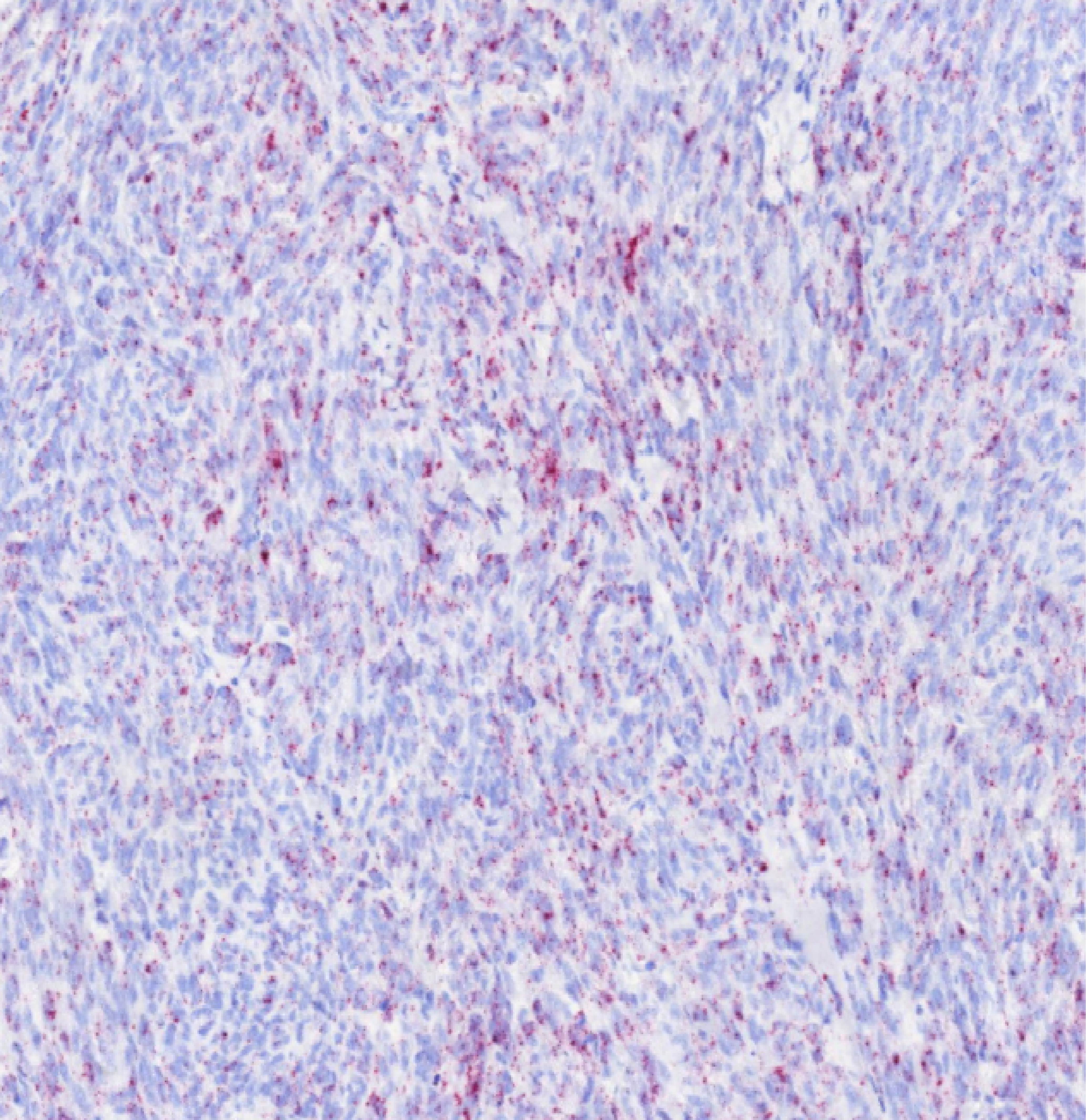 SK1 a checkpoint lipid kinase for immunotherapy