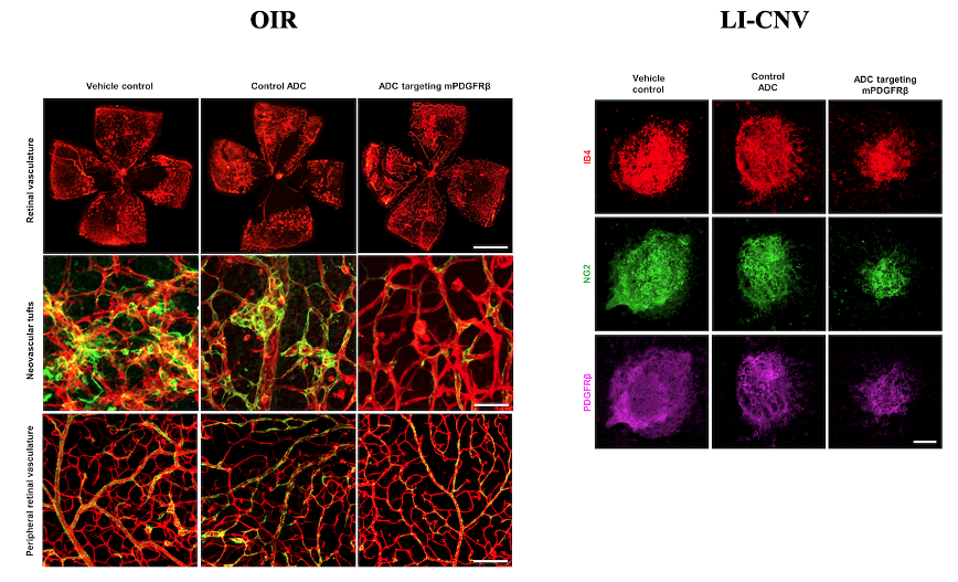 Specific ablation of PDGFRβ-overexpressing pericytes with antibody-drug conjugate potently inhibits pathologic ocular neovascularization in mouse models