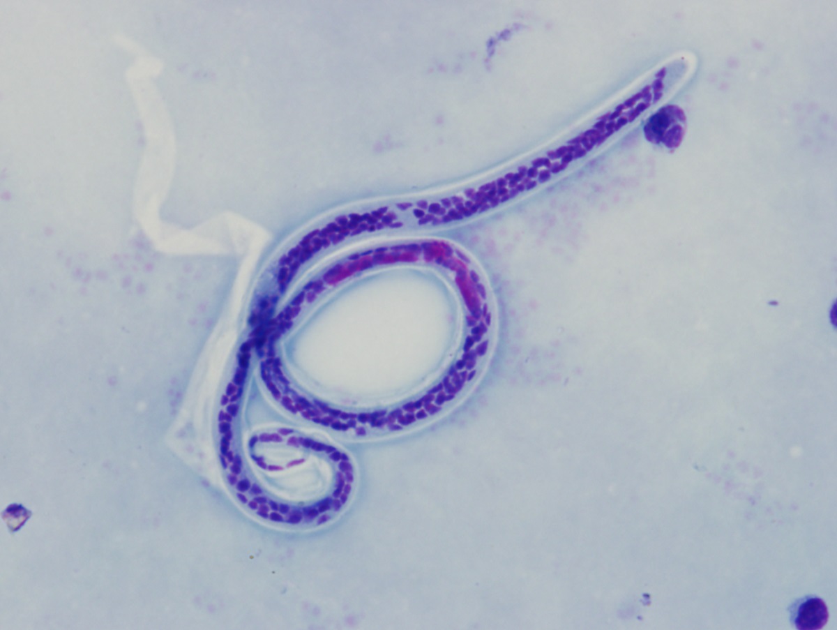 A New Method for Universal Parasite Detection by Targeted Deep Amplicon Sequencing 