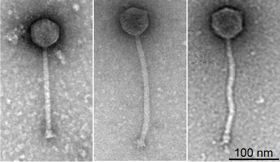 Engineered phage used to successfully treat drug-resistant Mycobacterium infection