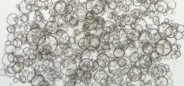 Can organoids revolutionize personalized treatment in cancer patients?