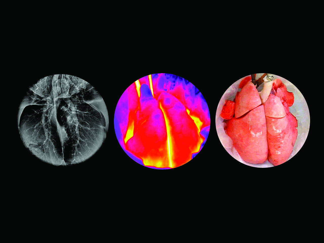Recovering injured lungs with cross-circulation