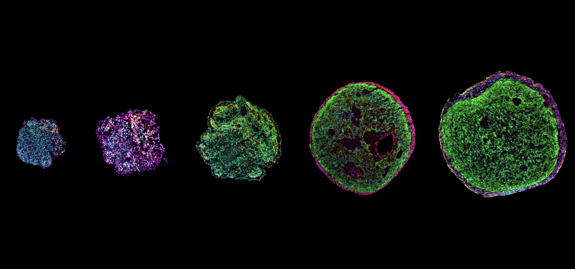 Epicardioids: a new window into the human epicardium’s function in development and disease
