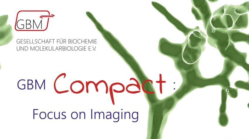 Successful GBM Compact Meeting "Focus on Imaging"