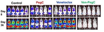 BCL-2 inhibition synergizes with glutamine depletion in complex karyotype AML