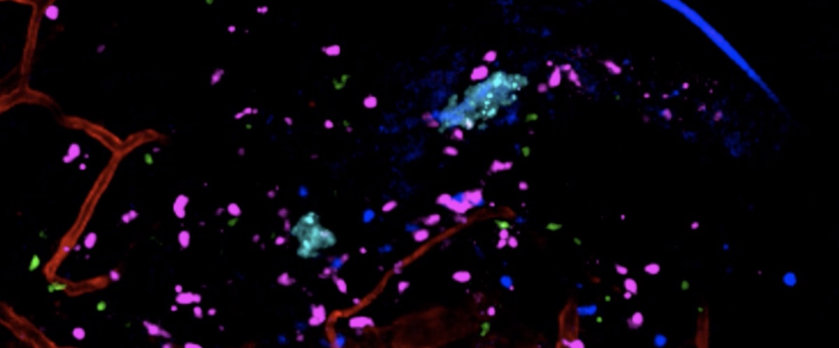 Does the canonical model give a complete picture of the innate immune response to bacterial invasion?