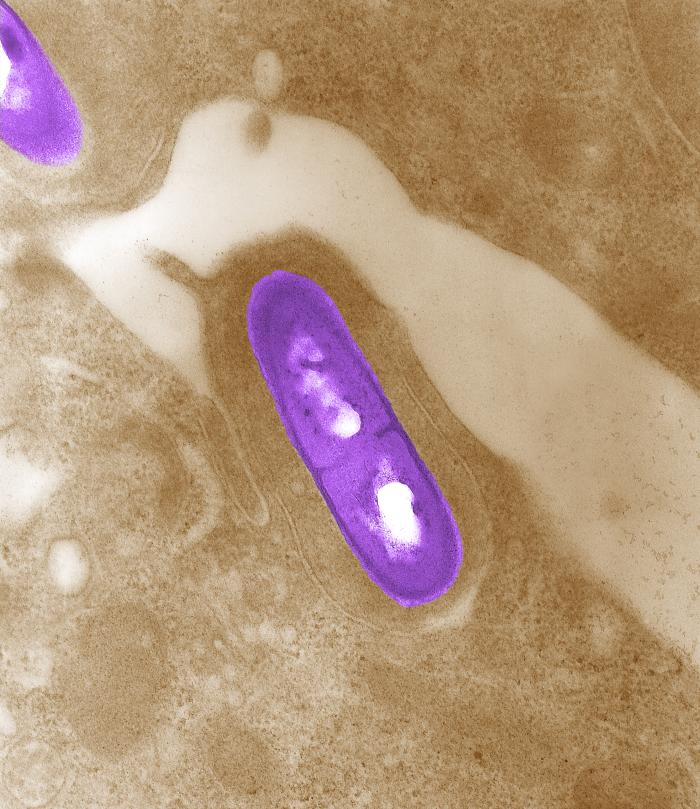 Nature Fights Back: The Complex Evolution of Antibiotic Resistance in Soil