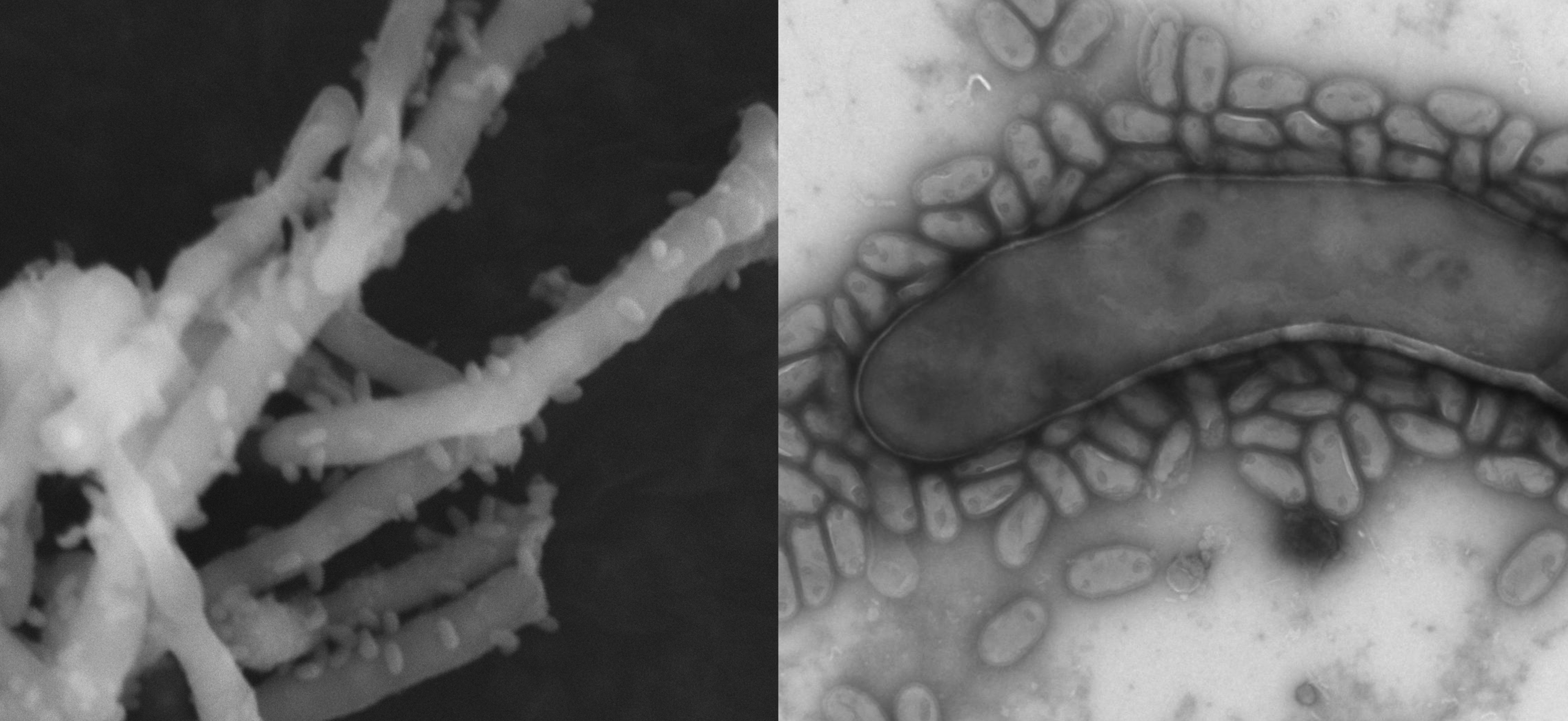 Ultra small parasitic bacterium with lytic ability