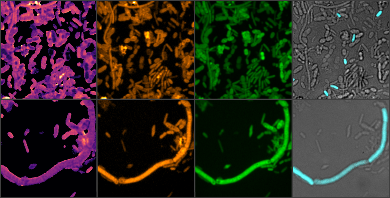 Beyond the target: how a Parkinson's drug doubles up as an inducer of microbial iron starvation