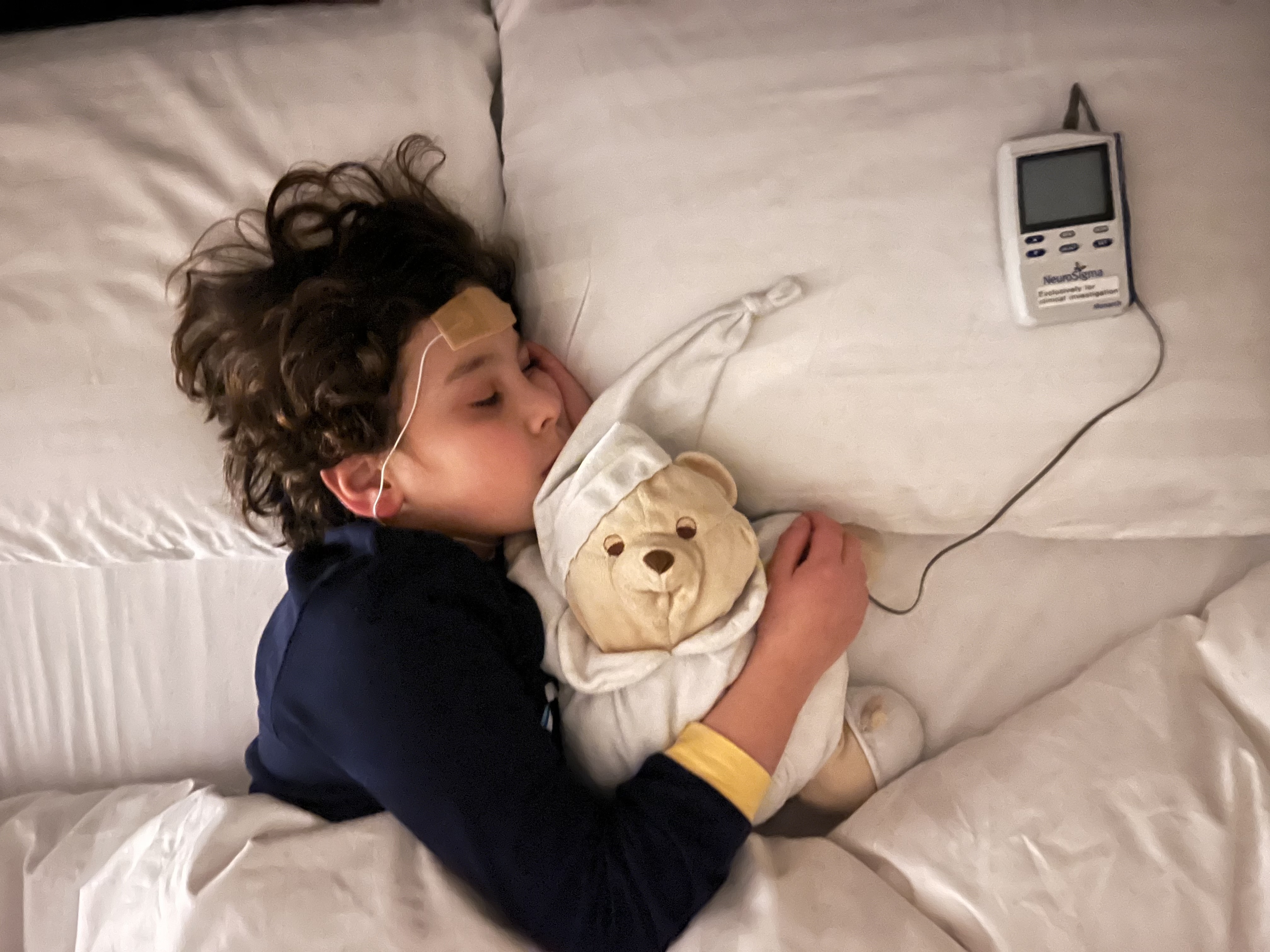 Trigeminal nerve stimulation for ADHD – from hype to broken hope