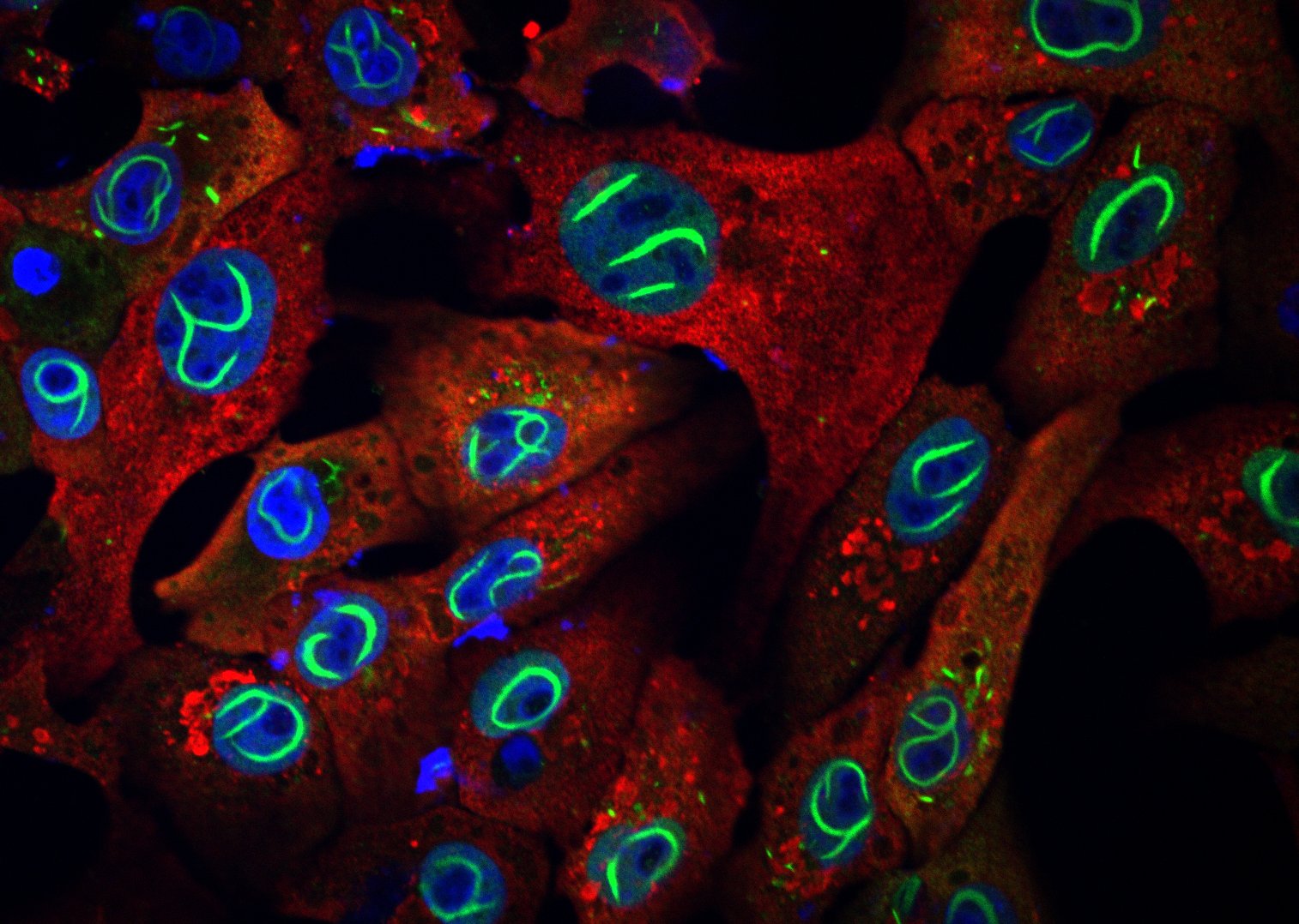 The fabulous viral protein NSs