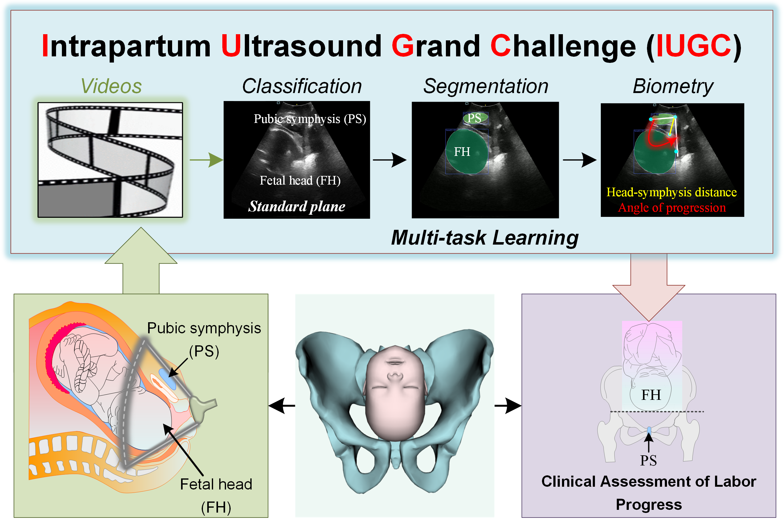 Jieyun Bai's Paper "Maternal-Fetal Ultrasound Video Dataset for End-to-End Intrapartum Biometry and Multi-task Learning "