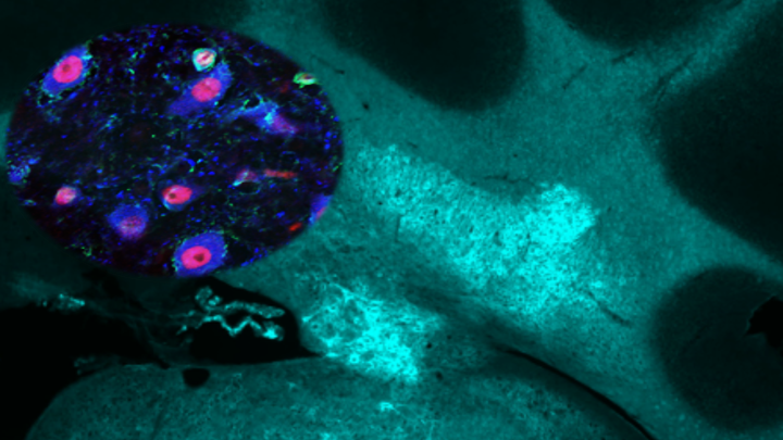 When the “motor cerebellum” started to speak about social behavior