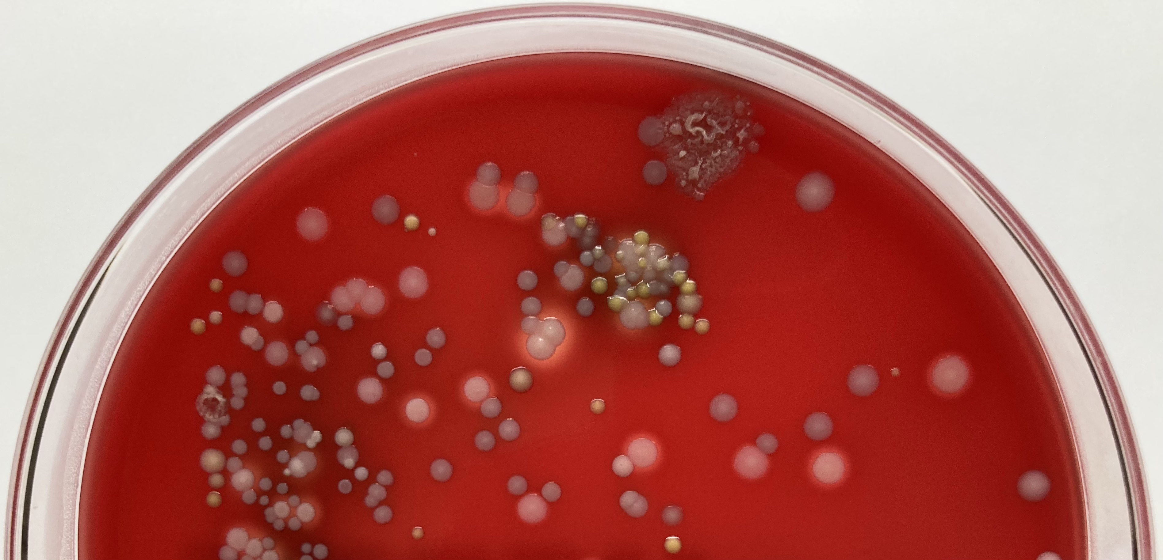 Pervasive horizontal gene transfer in coagulase-negative Staphylococcus
