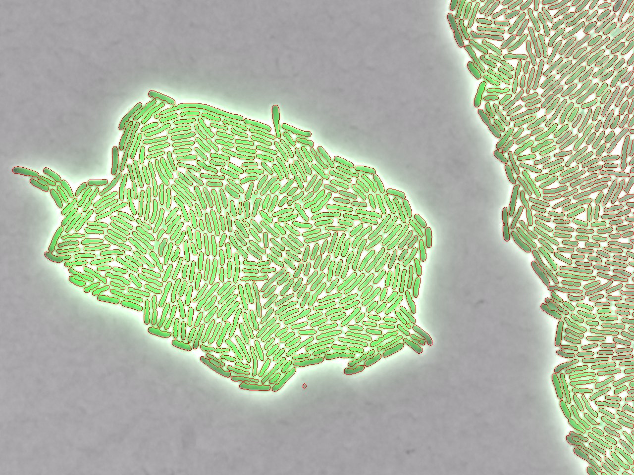 Single cell data and machine learning