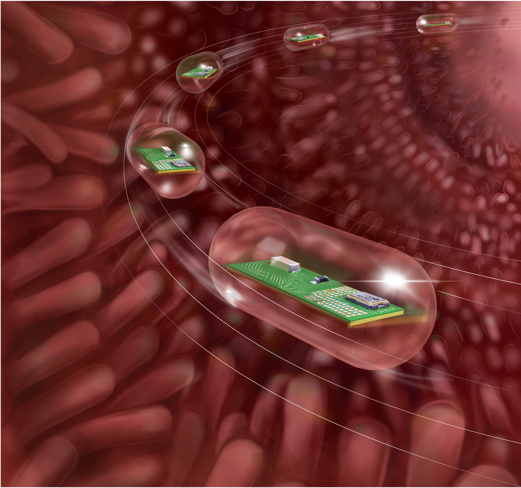 iMAG: Location-aware smart-pill for wireless GI-tract monitoring 