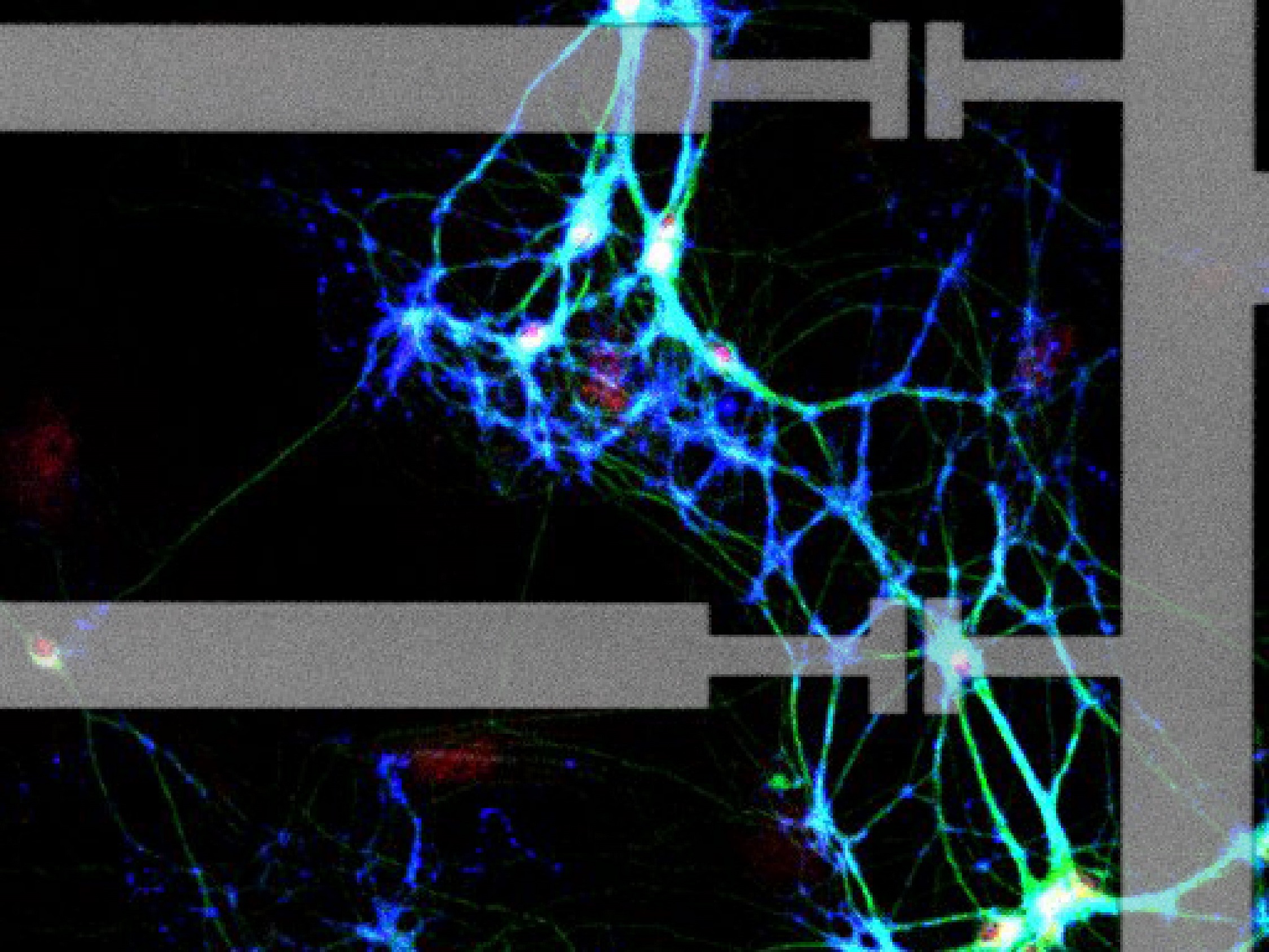 Membrane cholesterol mediates the cellular effects of monolayer graphene substrates