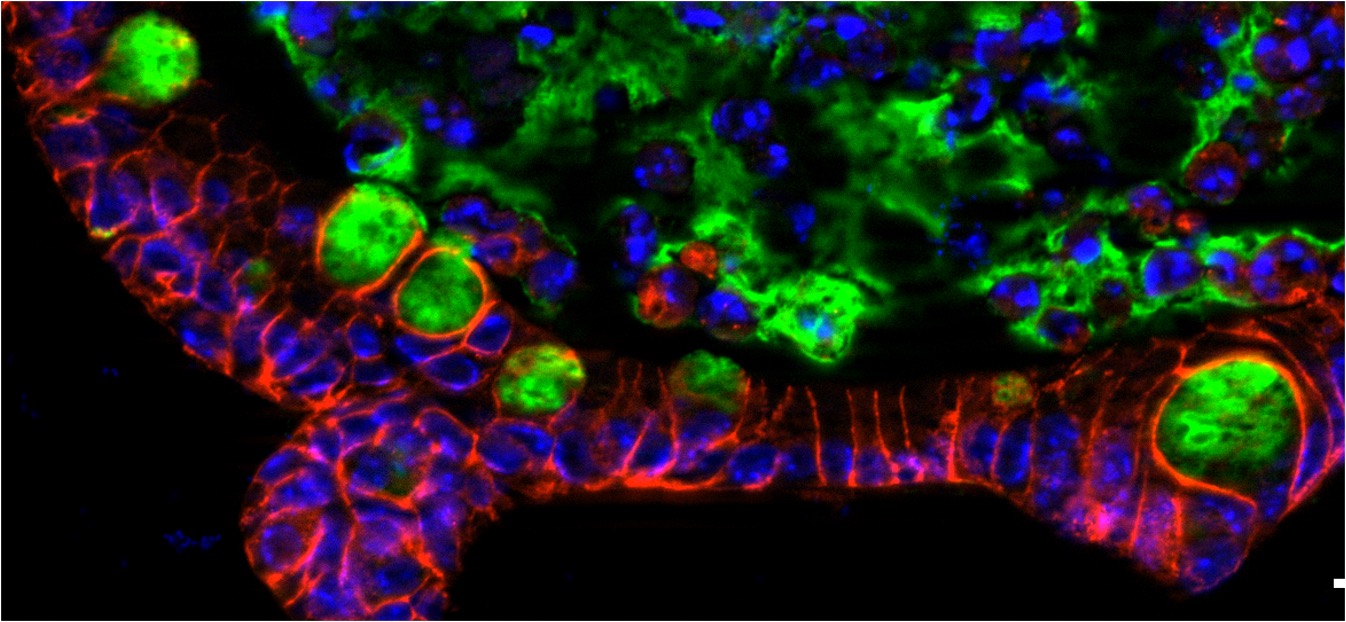 BRAFV600E drives dedifferentiation in small intestinal and colonic organoids and cooperates with mutant p53 and Apc loss in transformation