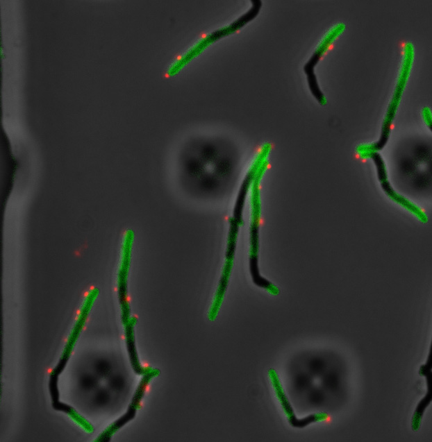 Imaging phage resistance in real time: The role of the Lsr2 protein in phage infection of Mycobacteria is shown using novel microscopy and engineered phages. 