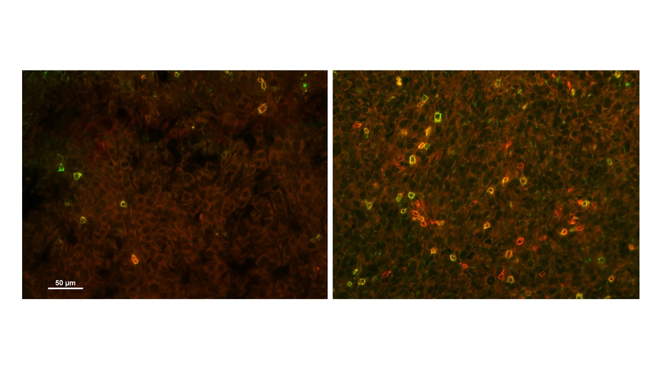 Targeting purine synthesis in ASS1 expressing tumors enhances the response to immune checkpoint inhibitors
