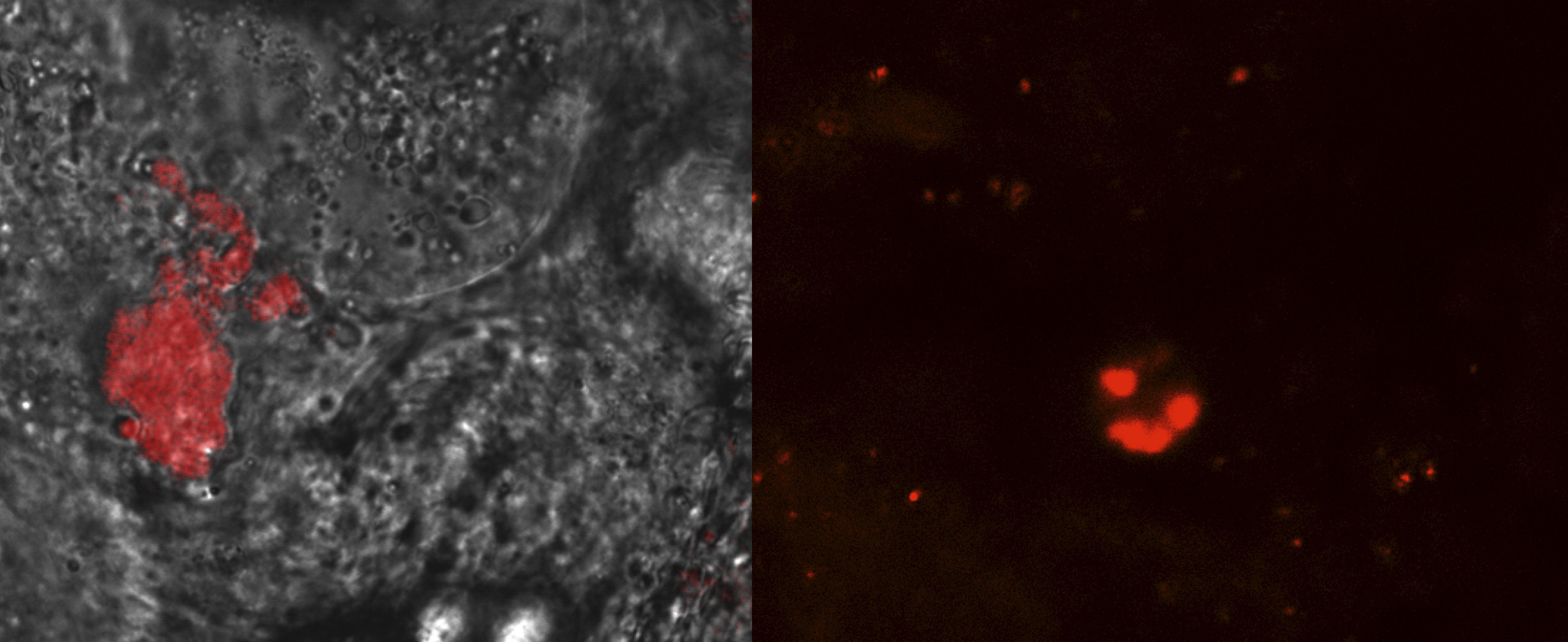 A step towards enlisting symbiotic microbes in the fight against malaria