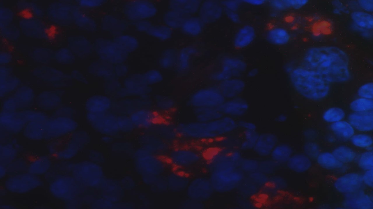 Genetically modified live attenuated vaccine against fatal visceral leishmaniasis