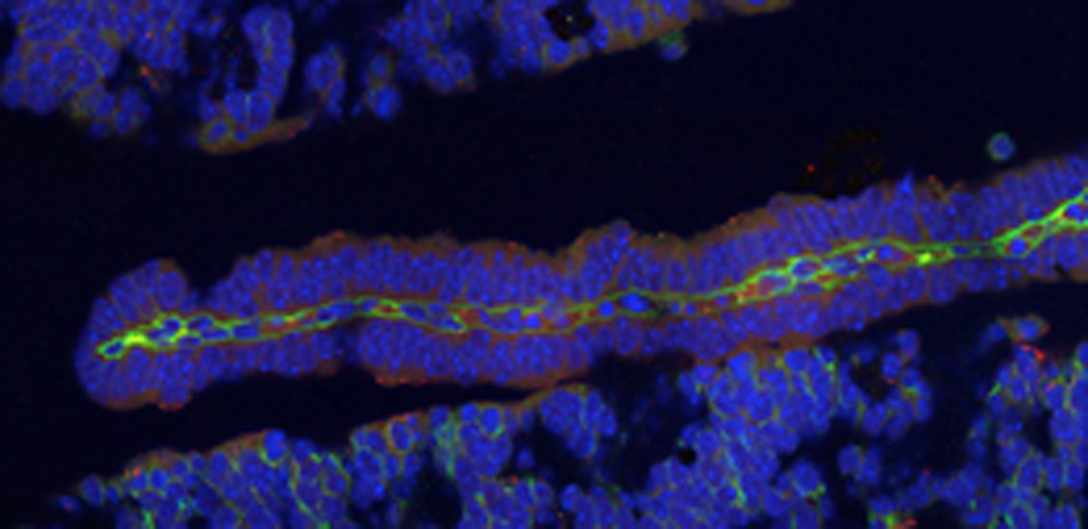 Roos Vandenbroucke works her way to success through barriers