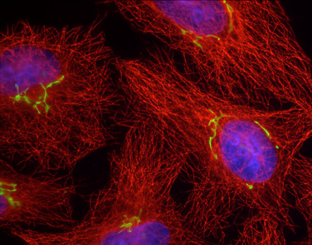 Biotech startup: Franck Perez, Honing Biosciences