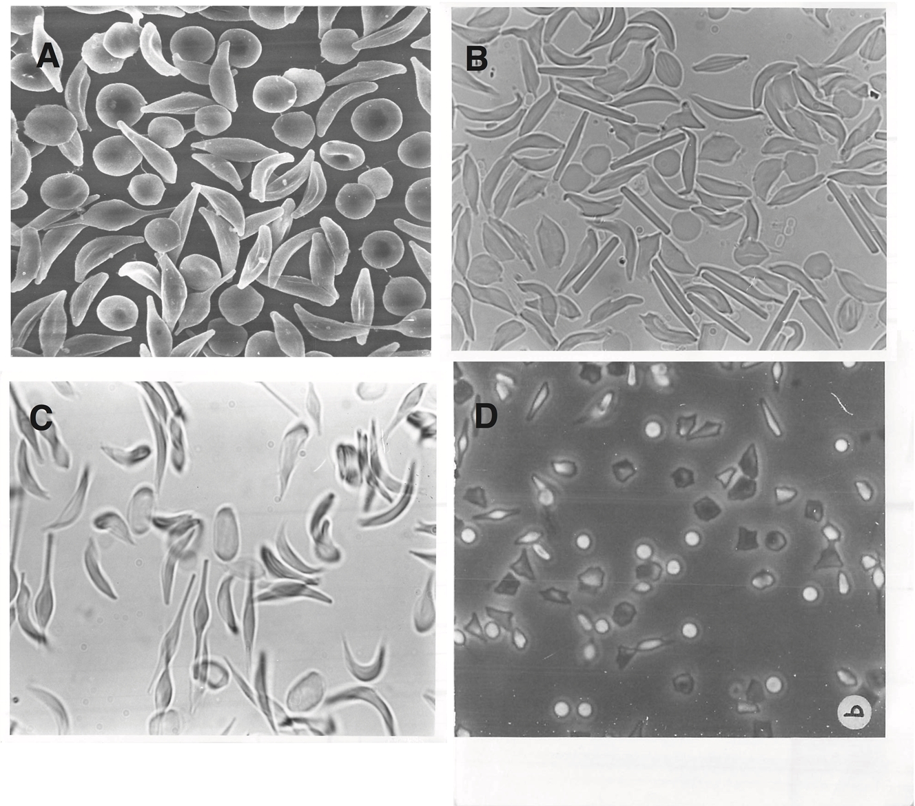 A bloody tale - sickle cells in deer 