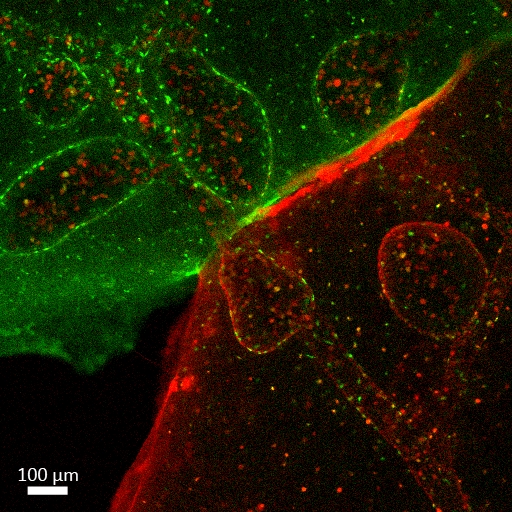 The evolutionary prospect on stem cell transplantation.