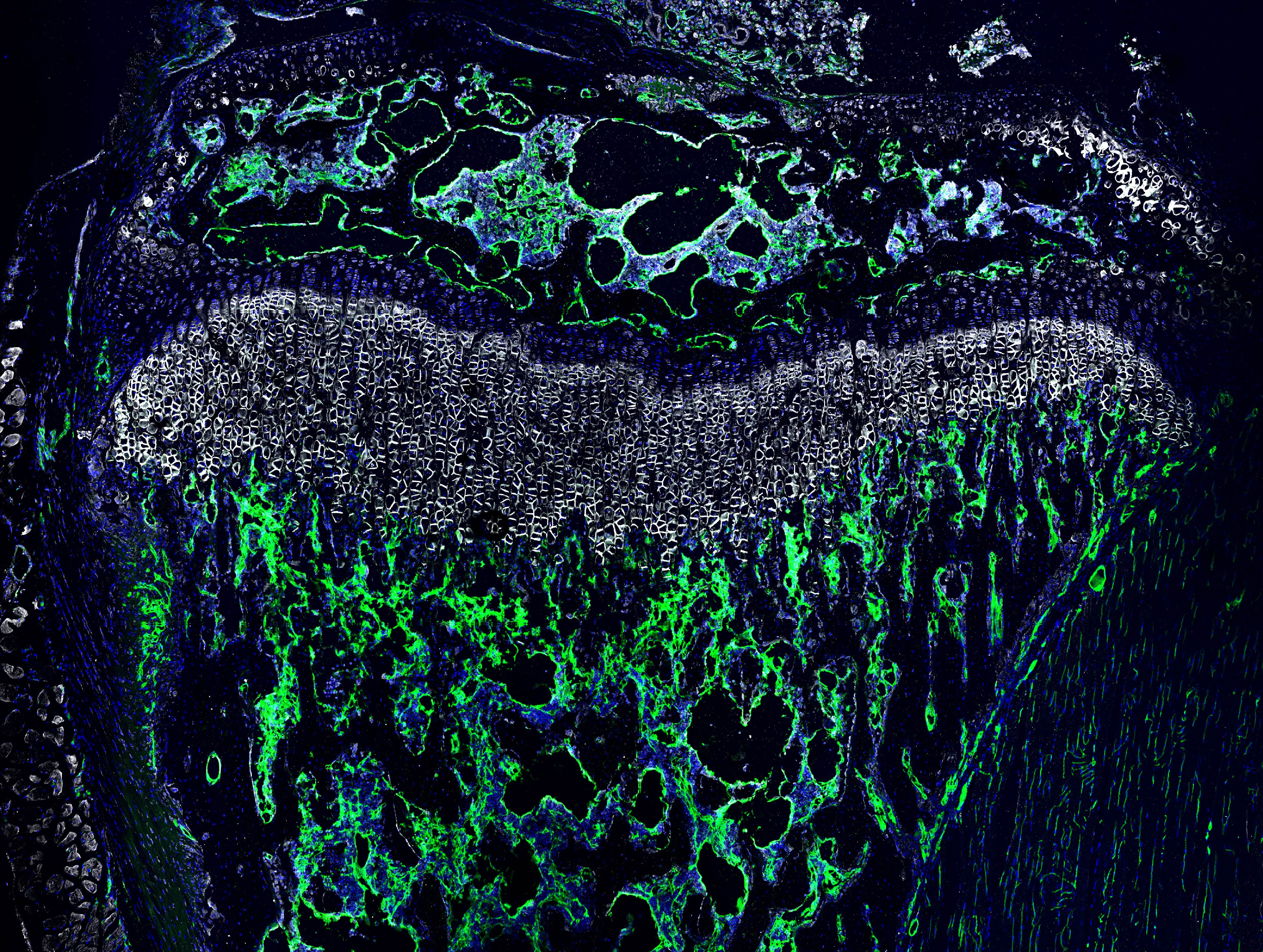 Unraveling the Marvels of Endothelial SMAD1/5 in Juvenile Long Bones