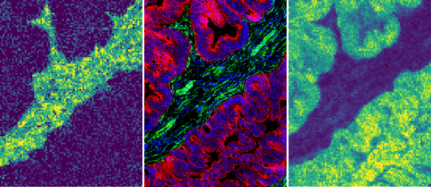 Spatially resolved single-cell metabolic profiling by multimodal MSI