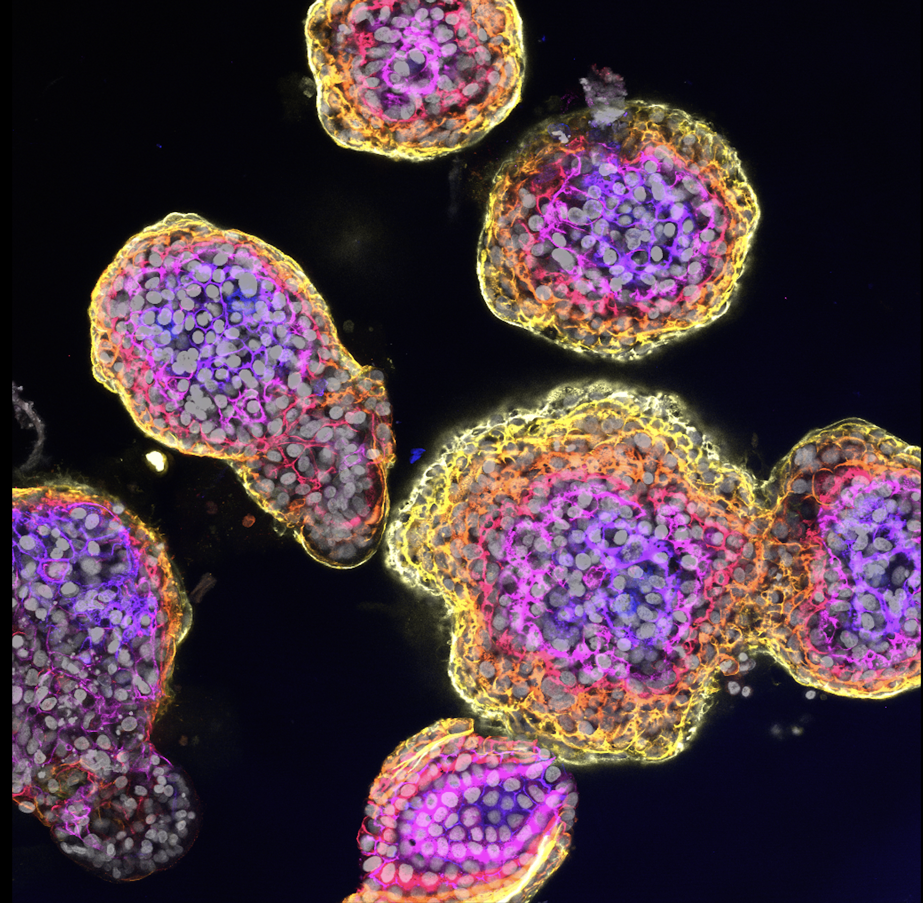Linking mutations to cancer development