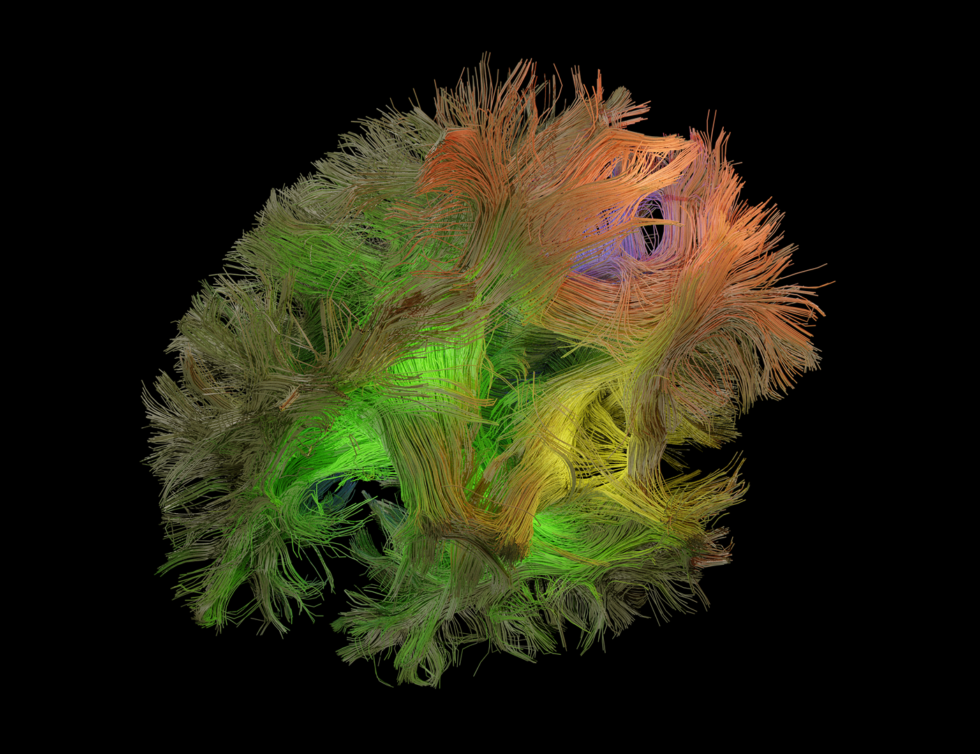 A flexible and accurate AI algorithm for neurotechnologies