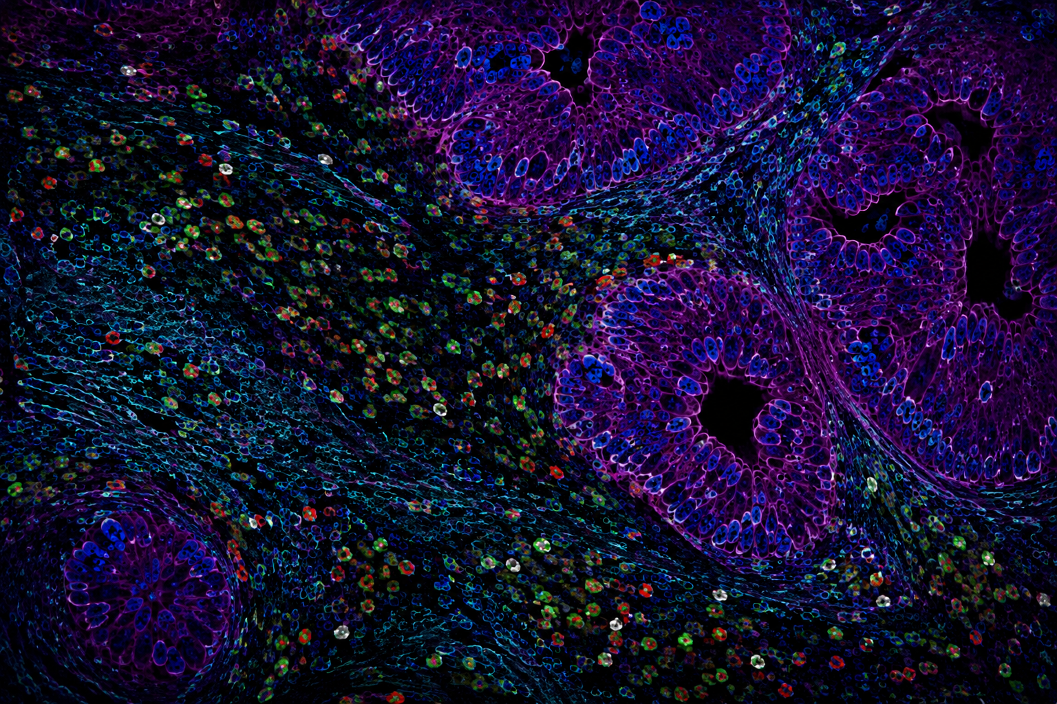 From last‑chance therapy to cancer boosters: A 2050 vision of immunoprevention in high‑risk populations