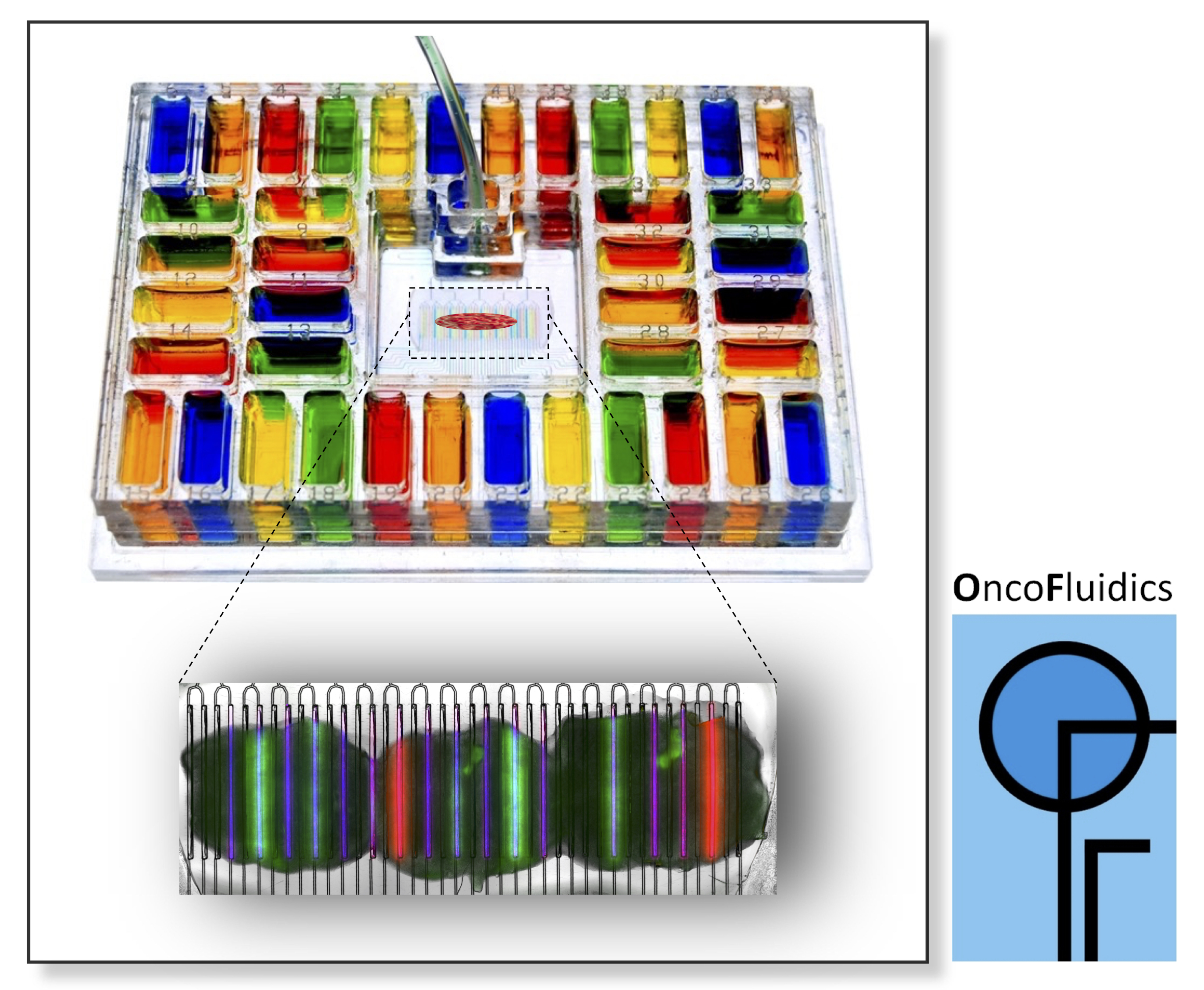 A marriage of tumor slices and microfluidics