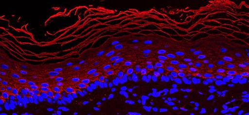 The search for ‘stemness’ genes in human epidermis meets the skin graft bioengineering domain: focus on KLF4