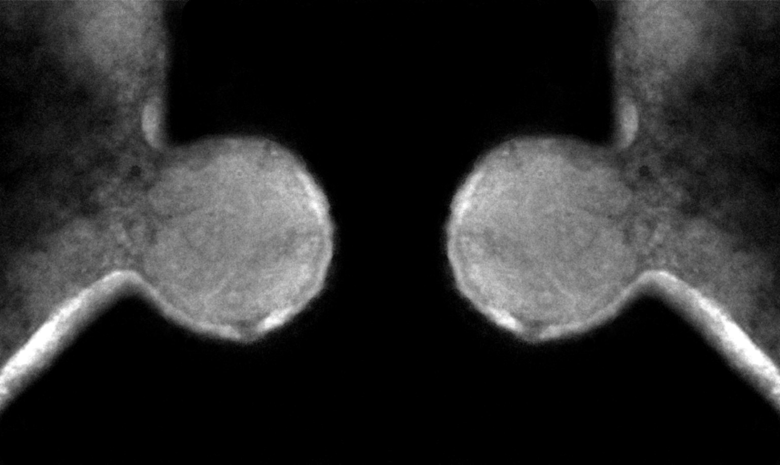 Discovery, hypothesis & Koch’s postulates – Nanohaloarchaeota are NOT free-living