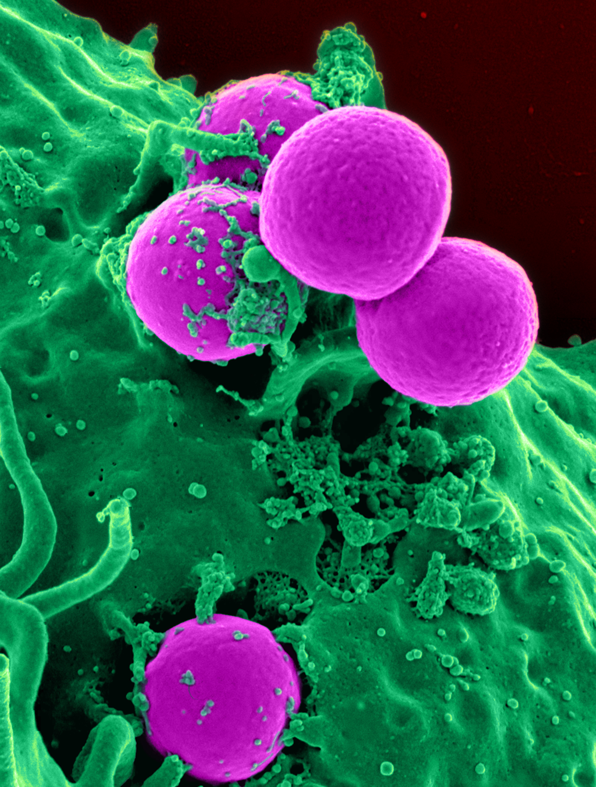 Host-jumping bacteria and the evolution of pathogenic clones