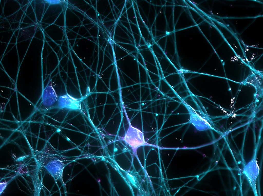 Project Outline: Designing a Stem Cell Model for Bulbar-Onset ALS