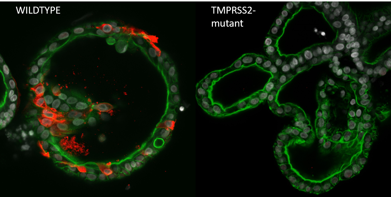 Genetically engineered organoid models for the establishment of coronavirus drug targets