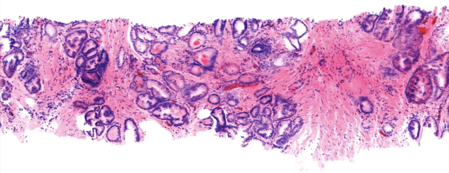 Transforming clinical pathology with light-sheet microscopy