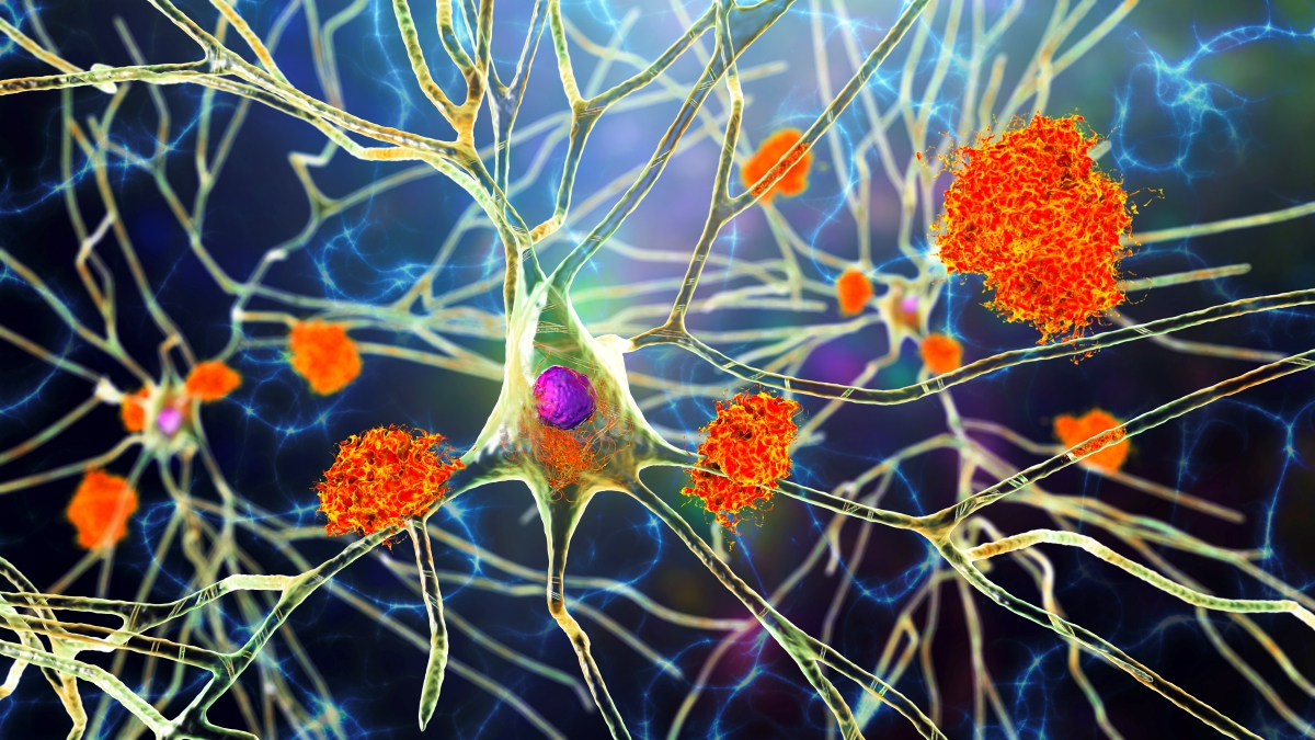 Call for papers: Brain metabolomics in dementia and neurological disease Collection
