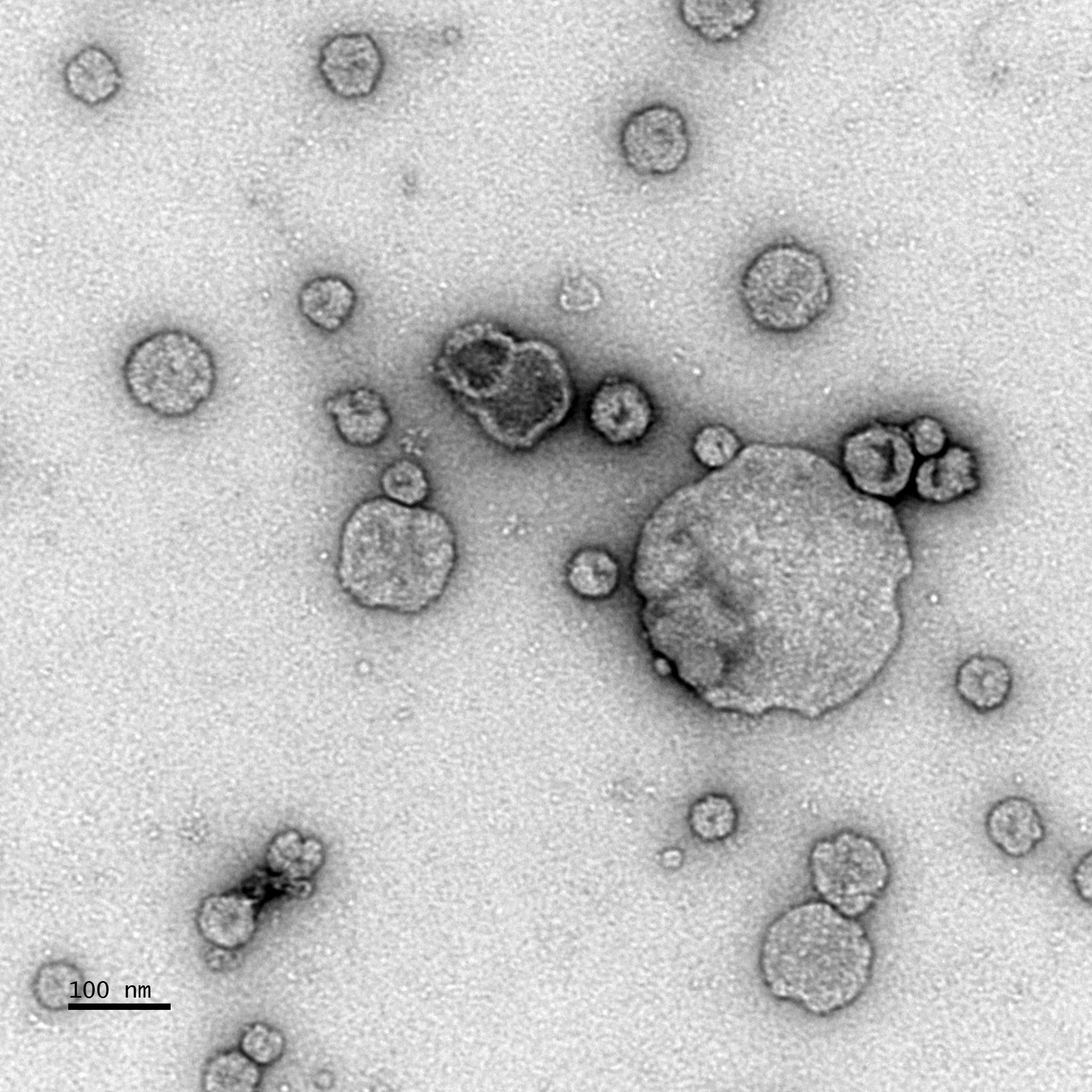 A novel protocol for isolating extracellular vesicles from biological tissues 