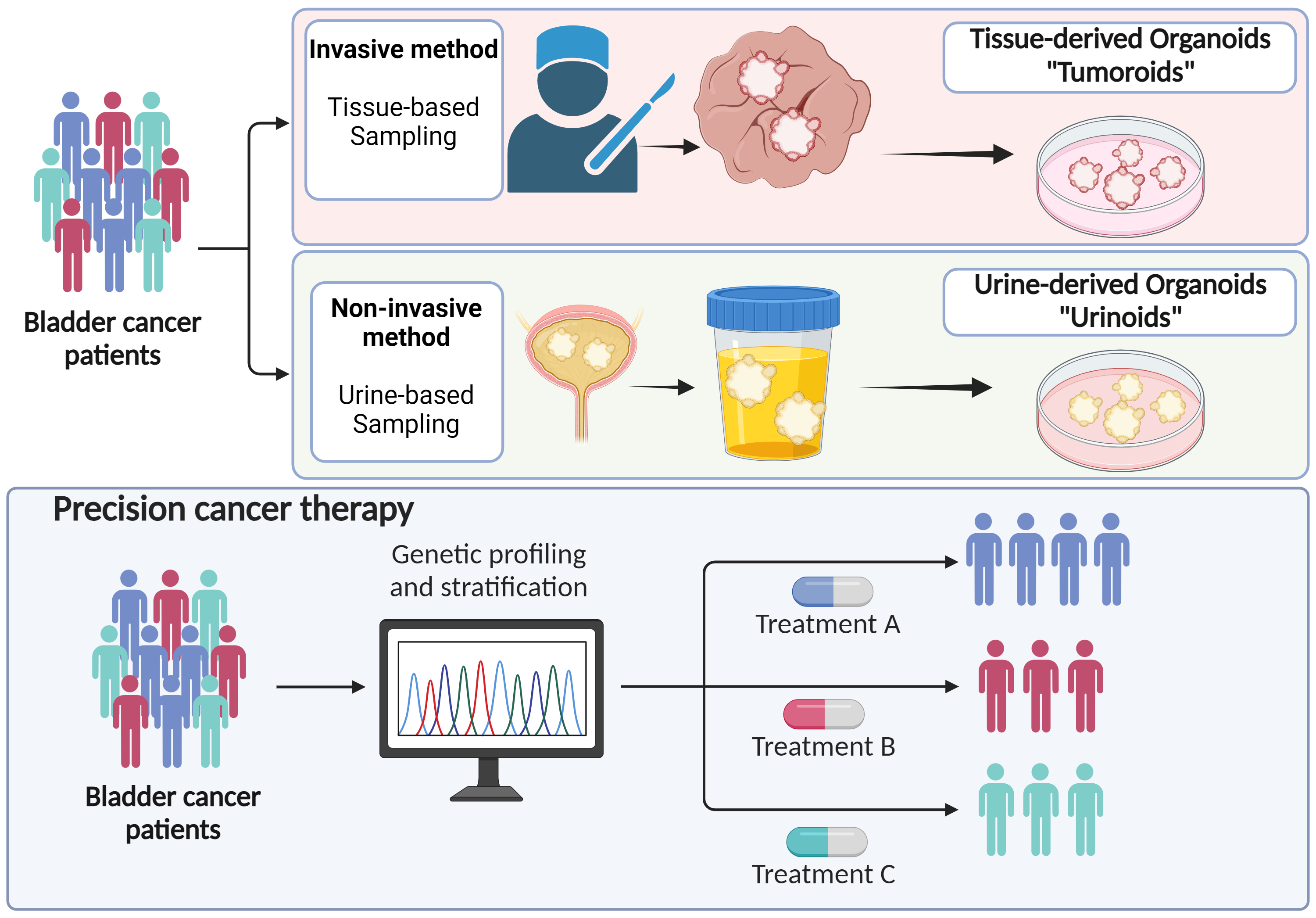 Urine-derived bladder cancer organoids (urinoids) as a tool for cancer longitudinal response monitoring and therapy adaptation – behind the paper