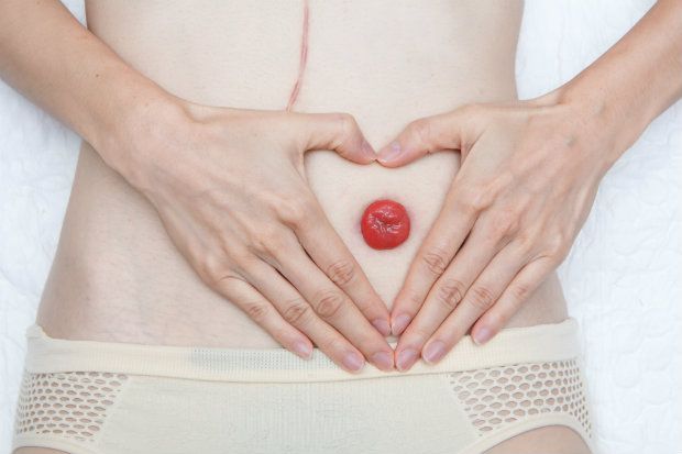 Stoma care: complications and advice