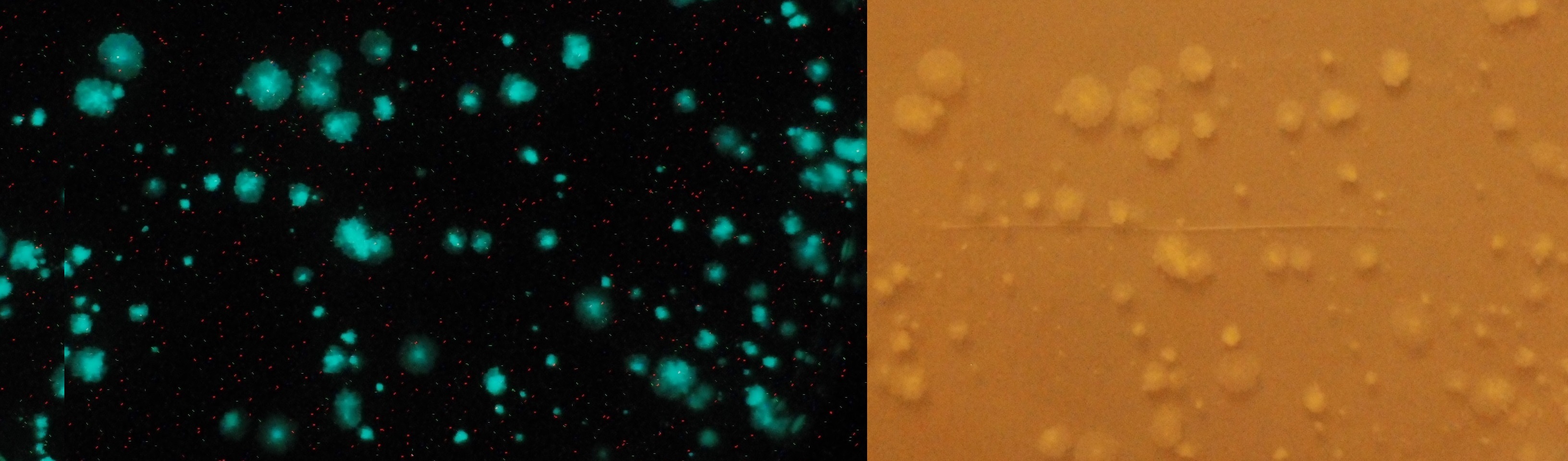 The Achilles' Heel Targeted by TB47 Is Protected in Select Mycobacteria. 