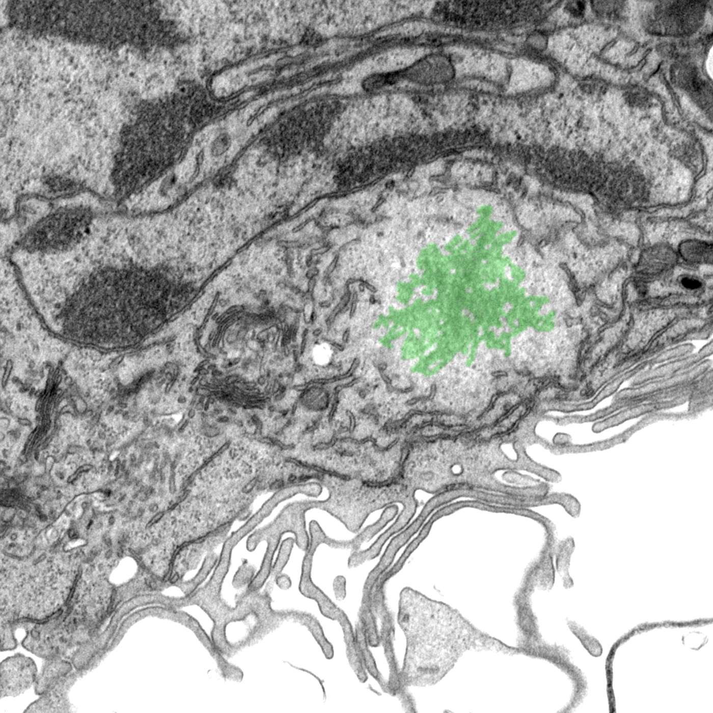 Plasma membrane damage is the key to inflammasome activation by Mycobacterium tuberculosis
