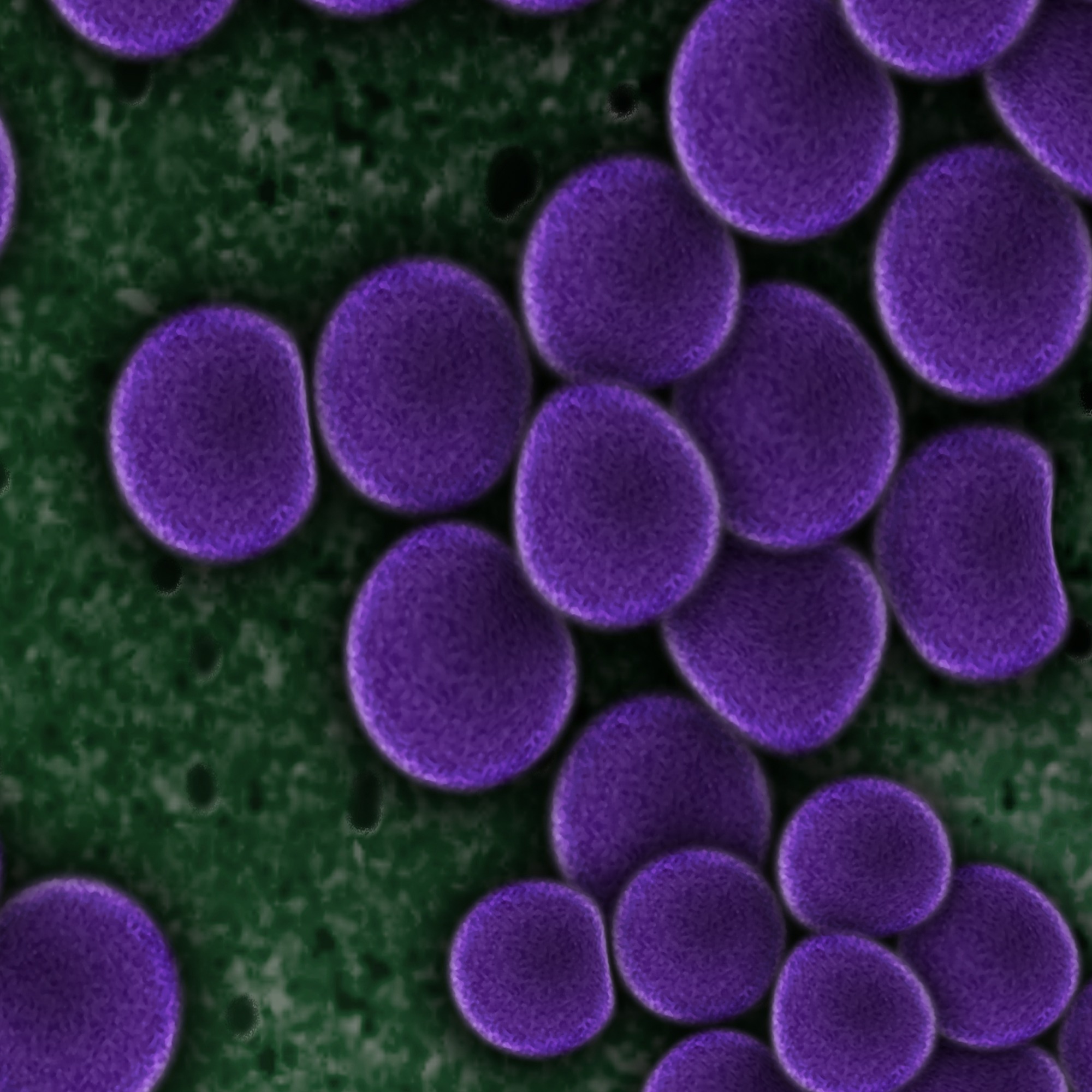 Probiotic Bacillus decolonizes pathogenic Staphylococcus aureus